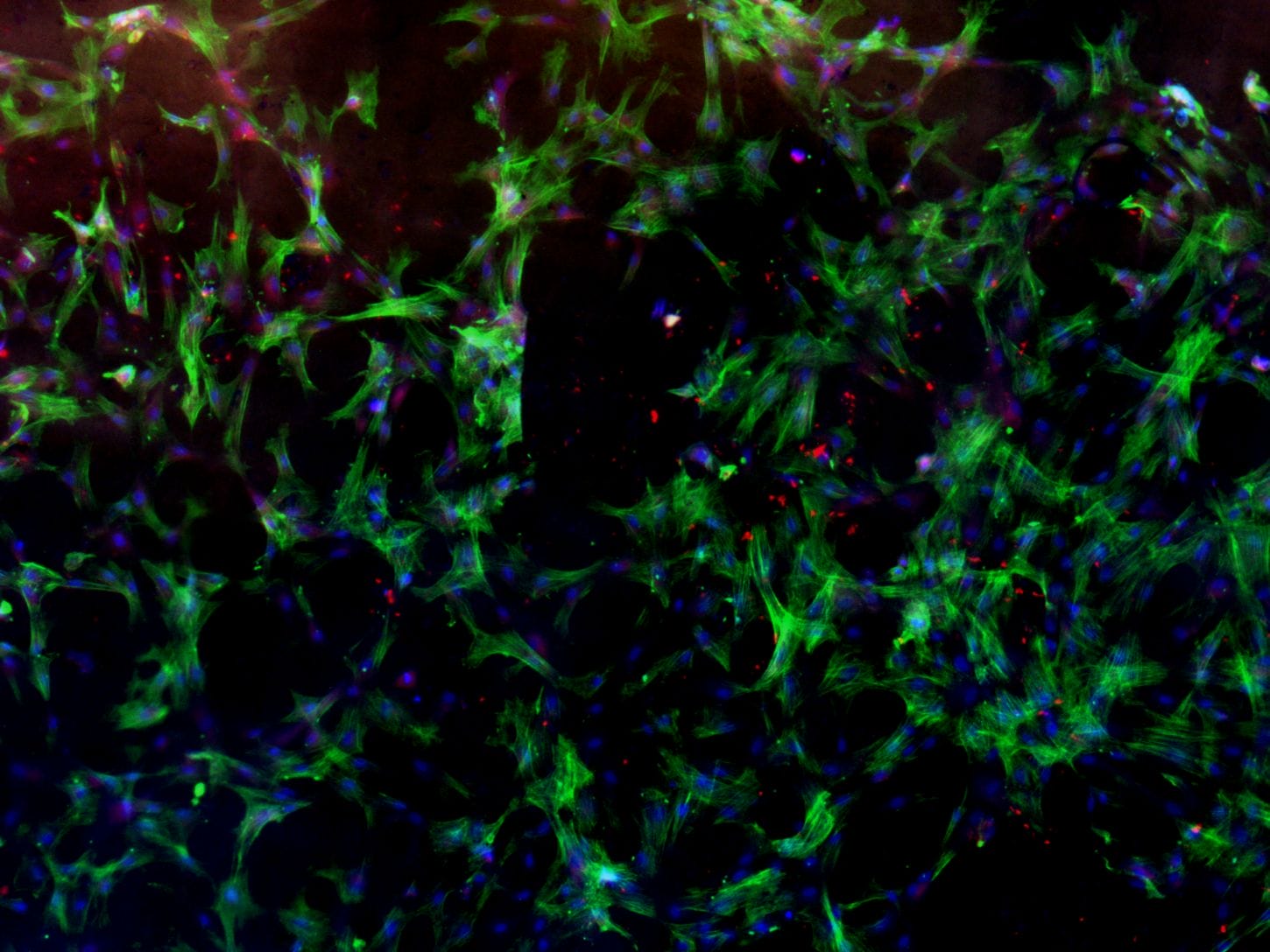 T-Block 72-Layer 300 Pore (Fibronectin Coated) Composite 1 (1) T-Block 72-Layer 300 Pore (Fibronectin Coated) Composite 1 (1)